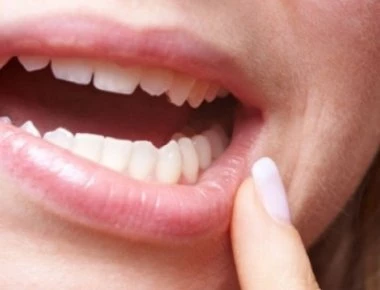 Ούλα που ματώνουν: Γιατί και πότε συμβαίνει- Τι λύσεις υπάρχουν